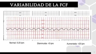 Vigilancia fetal intraparto y alumbramiento DEFINITIVO.pptx
