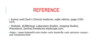 REFERENCE
 Kumar and Clark’s Clinical medicine, eight edition, page (536-
537).
 Shahedi, SLEWorkup: Laboratory Studies, Imaging Studies,
Procedures. [online] Emedicine.medscape.com.
https://www.hxbenefit.com/malar-rash-butterfly-rash-pictures-causes-
and-treatment.html
 
