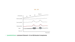 • Iperattività fasica : contrazioni fluttuanti > 15 cm H20 durante il riempimento
 
