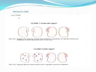 Bheringet al. (1996)