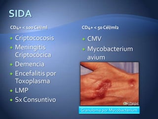 CD4+ < 100 Cél/ml   CD4+ < 50 Cél/ml2

 Criptococosis      CMV
 Meningitis         Mycobacterium
  Criptocócica        avium
 Demencia
 Encefalitis por
  Toxoplasma
 LMP
 Sx Consuntivo
                    Granuloma por Mycobacterium
 