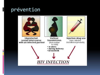 prévention 
 