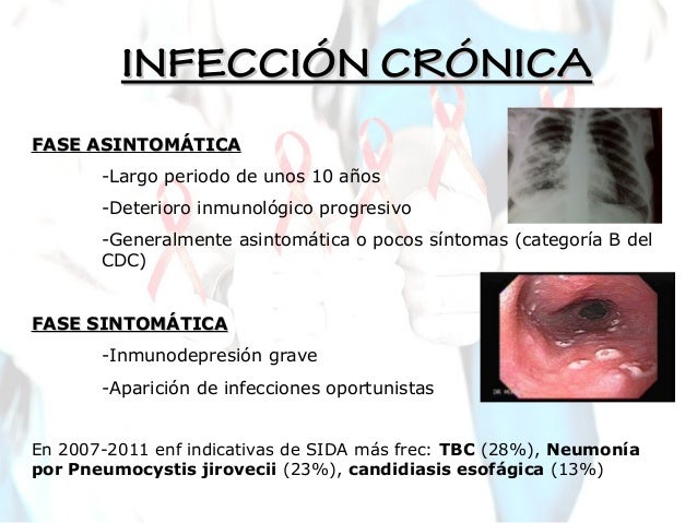 Vih en atencion primaria