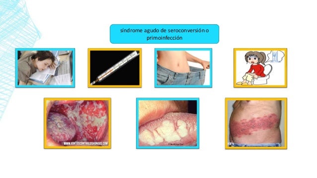 infección natural por el VIH