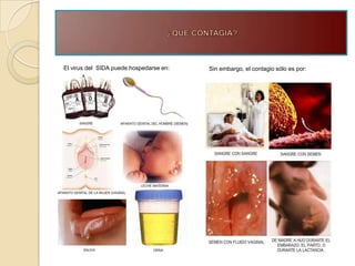 El virus del SIDA puede hospedarse en:   Sin embargo, el contagio sólo es por:
 