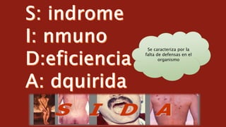 Se caracteriza por la
falta de defensas en el
organismo
 