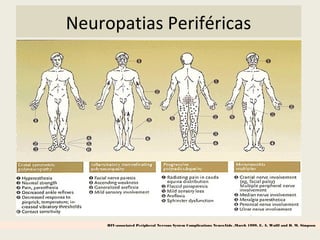 Neuropatias Periféricas
HIV-associated Peripheral Nervous System Complications NeuroAids ,March 1999, E. A. Wulff and D. M. Simpson
 