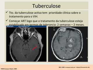 Tuberculose
 Tto. da tuberculose activa tem prioridade clínica sobre o
tratamento para o VIH.
 Começar ART logo que o tratamento da tuberculose esteja
estabilizado em termos de tolerancia: 2 semanas – 2 meses.
HIV/AIDS treatment and care : Clinical Protocols for the
WHO European Region, 2008
 