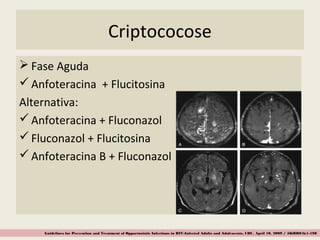 Criptococose
 Fase Aguda
Anfoteracina + Flucitosina
Alternativa:
Anfoteracina + Fluconazol
Fluconazol + Flucitosina
Anfoteracina B + Fluconazol
Guidelines for Prevention and Treatment of Opportunistic Infections in HIV-Infected Adults and Adolescents, CDC, April 10, 2009 / 58(RR04);1-198
 