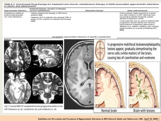Guidelines for Prevention and Treatment of Opportunistic Infections in HIV-Infected Adults and Adolescents, CDC, April 10, 2009 /
 