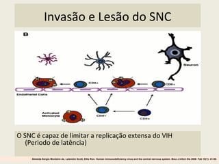 Invasão e Lesão do SNC
O SNC é capaz de limitar a replicação extensa do VIH
(Periodo de latência)
Almeida Sergio Monteiro de, Letendre Scott, Ellis Ron. Human immunodeficiency virus and the central nervous system. Braz J Infect Dis 2006 Feb 10(1): 41-50.
 