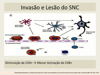 Invasão e Lesão do SNC
Diminuição de CD4+ → Menor Activação de CD8+
Almeida Sergio Monteiro de, Letendre Scott, Ellis Ron. Human immunodeficiency virus and the central nervous system. Braz J Infect Dis 2006 Feb 10(1): 41-50.
 