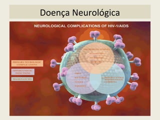 Doença Neurológica
 