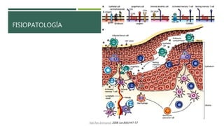 FISIOPATOLOGÍA
Nat Rev Immunol. 2008 Jun;8(6):447-57
 
