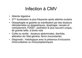 Infection à CMV
•  Atteinte digestive
•  2ème localisation la plus fréquente après atteinte oculaire
•  Oesophagite et gastrite se manifestent par des douleurs
   rétrosternales ou épigastriques, dysphagie, nausée et
   vomissement, FOGD : ulcération le plus souvent unique,
   de grande taille, à bords nets
•  Colite ou rectite : douleurs abdominales, diarrhée,
   altération de l’état général, fièvre (inconstante)
•  Diagnostic : histologique avec la présence d’inclusions
   intranucléaires ou intracytoplasmiques
 