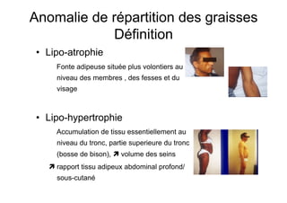 Anomalie de répartition des graisses
                   Définition
           •  Lipo-atrophie
                         Fonte adipeuse située plus volontiers au
                         niveau des membres , des fesses et du
                         visage



           •  Lipo-hypertrophie
                         Accumulation de tissu essentiellement au
                         niveau du tronc, partie superieure du tronc
                         (bosse de bison),  volume des seins
                     rapport tissu adipeux abdominal profond/
                         sous-cutané

Prise en charge thérapeutique des personnes infectées par le VIH. Recommandations du groupe d’expert. Rapport 2004 du Pr JF Delfraissy
 