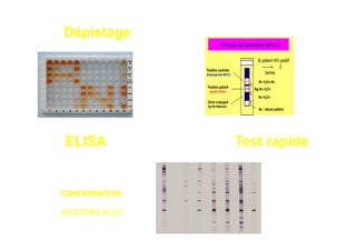 Dépistage




ELISA          Test rapide


CONFIRMATION

WESTERN BLOT
 