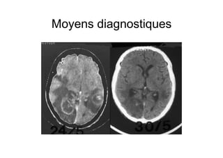 Moyens diagnostiques
 