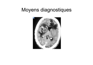 Moyens diagnostiques
 