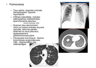 •  Pulmonaires

   –  Toux sèche, dyspnée,crachats
      hémoptoiques, hypoxie-
      hypocapnie
   –  Infiltrats interstitiels, nodules,
      adénopathies médiastinales,
      épanchements pleuraux
                 (Gruden Radiology 1995)
   –  Scanner plus discriminant :
      micro ou macro nodules souvent
      spiculés, dans les parties
      externes ou sous pleuraux,
      épaississement
      péribronchovasculaire
   –  Fibroscopie bronchique : lésions
      bronchiques angiomateuses,
      LBA : Augmentation des
      sidérophages
 