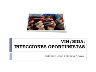 VIH/SIDA:
INFECCIONES OPORTUNISTAS
Salomón José Valencia Anaya
 