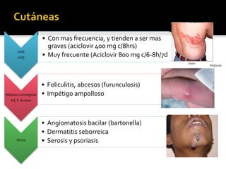 VHS
VHZ
• Con mas frecuencia, y tienden a ser mas
graves (aciclovir 400 mg c/8hrs)
• Muy frecuente (Aciclovir 800 mg c/6-8h/7d
Molusco contagioso
Inf, S. Aureus
• Foliculitis, abcesos (furunculosis)
• Impétigo ampolloso
Otros
• Angiomatosis bacilar (bartonella)
• Dermatitis seborreica
• Serosis y psoriasis
 