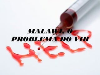 MALAWI, O
PROBLEMA DO VIH
 