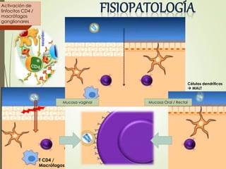 Mucosa Oral / Rectal
T CD4 /
Macrófagos
Células dendríticas
 MALT
Mucosa vaginal
Activación de
linfocitos CD4 /
macrófagos
ganglionares
 