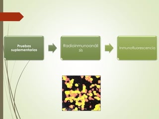 Pruebas
suplementarias
Radioinmunoanáli
sis
Inmunofluorescencia
 
