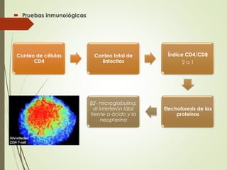  Pruebas inmunológicas
Conteo de células
CD4
Conteo total de
linfocitos
Índice CD4/CD8
2 a 1
Electroforesis de las
proteínas
β2- microglobulina,
el interferón lábil
frente a ácido y la
neopterina
 