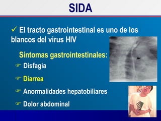 El tracto gastrointestinal es uno de los blancos del virus HIV Síntomas gastrointestinales: Disfagia Diarrea Anormalidades hepatobiliares Dolor abdominal SIDA 