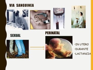 VIA SANGUINEA
PERINATAL
•IN UTERO
•DURANTE
•LACTANCIA
SEXUAL
 