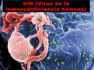 VIH (Virus de laVIH (Virus de la
inmunodeficiencia humana)inmunodeficiencia humana)
 