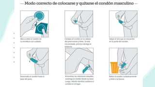 El modo correcto de usar el condón masculino
 