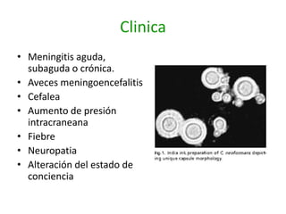 Clinica
• Meningitis aguda,
  subaguda o crónica.
• Aveces meningoencefalitis
• Cefalea
• Aumento de presión
  intracraneana
• Fiebre
• Neuropatia
• Alteración del estado de
  conciencia
 