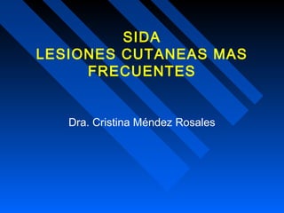 SIDA
LESIONES CUTANEAS MAS
FRECUENTES
Dra. Cristina Méndez Rosales
 