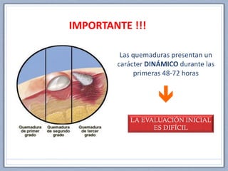 Las quemaduras presentan un
carácter DINÁMICO durante las
primeras 48-72 horas

LA EVALUACIÓN INICIAL
ES DIFÍCIL
IMPORTANTE !!!
 