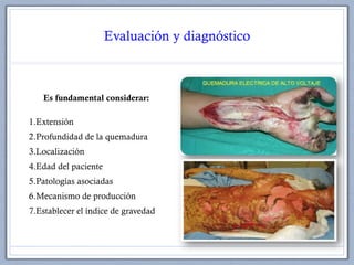 Evaluación y diagnóstico
Es fundamental considerar:
1.Extensión
2.Profundidad de la quemadura
3.Localización
4.Edad del paciente
5.Patologías asociadas
6.Mecanismo de producción
7.Establecer el índice de gravedad
 