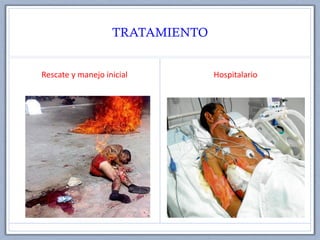 TRATAMIENTO
Rescate y manejo inicial Hospitalario
 