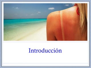 Introducción
 