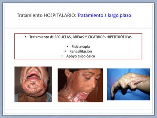 Tratamiento HOSPITALARIO: Tratamiento a largo plazo
• Tratamiento de SECUELAS, BRIDAS Y CICATRICES HIPERTRÓFICAS
• Fisioterapia
• Rehabilitación
• Apoyo psicológico
 