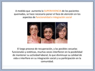A medida que aumenta la SUPERVIVENCIA de los pacientes
quemados, se hace necesario poner el foco de atención en los
aspectos de funcionalidad e integración social
El largo proceso de recuperación, y las posibles secuelas
funcionales y estéticas, muchas veces interfieren en la posibilidad
de mantener su actividad laboral, lo que disminuye su calidad de
vida e interfiere en su integración social y su participación en la
comunidad.
 