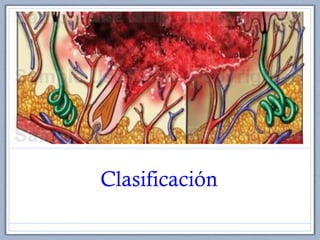 Clasificación
 
