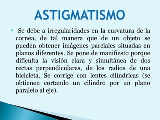 Se debe a irregularidades en la curvatura de la cornea, de tal manera que de un objeto se pueden obtener imágenes parciales situadas en planos diferentes. Se pone de manifiesto porque dificulta la visión clara y simultánea de dos rectas perpendiculares, de los radios de una bicicleta. Se corrige con lentes cilíndricas (se obtienen cortando un cilindro por un plano paralelo al eje).  