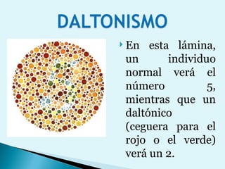 En esta lámina, un individuo normal verá el número 5, mientras que un daltónico (ceguera para el rojo o el verde) verá un 2. 
