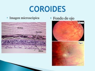 Imagen microscópica Fondo de ojo 