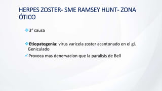 HERPES ZOSTER- SME RAMSEY HUNT- ZONA
ÓTICO
3° causa
Etiopatogenia: virus varicela zoster acantonado en el gl.
Geniculado
Provoca mas denervacion que la paralisis de Bell
 