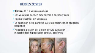 HERPES ZOSTER
Clinica: PFP + vesículas oticas
Las vesículas pueden extenderse a cornea y cara
Forma frustree: sin vesículas
La aparición de la parálisis suele coincidir con la erupcion
herpetica
Asociado a lesión del VIII en el 40% cursa con
inestabilidad, hipoacusia/ cofosis, acufenos
 