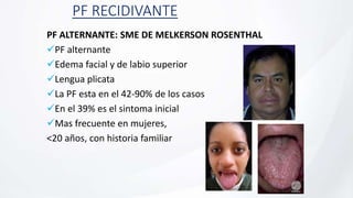 PF RECIDIVANTE
PF ALTERNANTE: SME DE MELKERSON ROSENTHAL
PF alternante
Edema facial y de labio superior
Lengua plicata
La PF esta en el 42-90% de los casos
En el 39% es el sintoma inicial
Mas frecuente en mujeres,
<20 años, con historia familiar
 