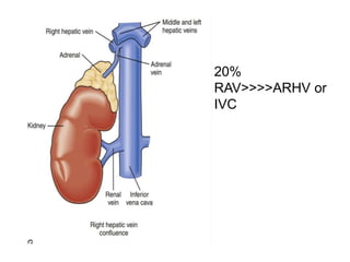 • 20%
RAV>>>>ARHV or
IVC
 